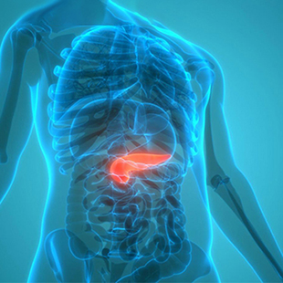 Diabetes treatment by Naila's Goldenberg Endocrinology clinic in Maison Ohio