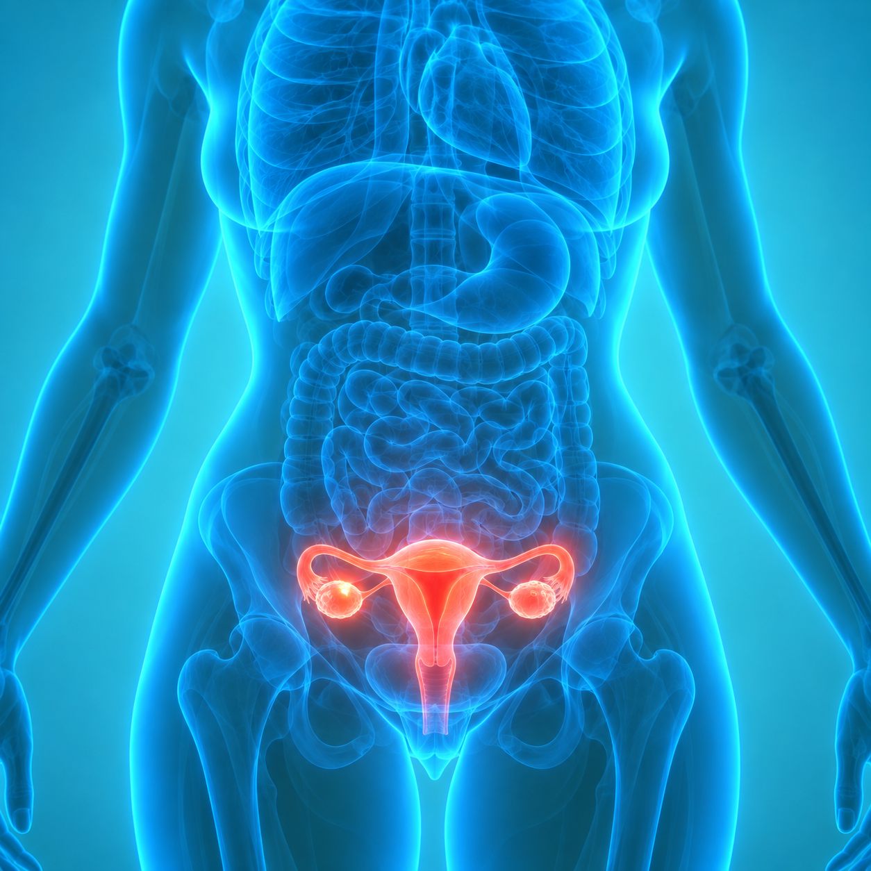 PMOS – Formerly PCOS , Functional Endocrinology, Mason, Ohio